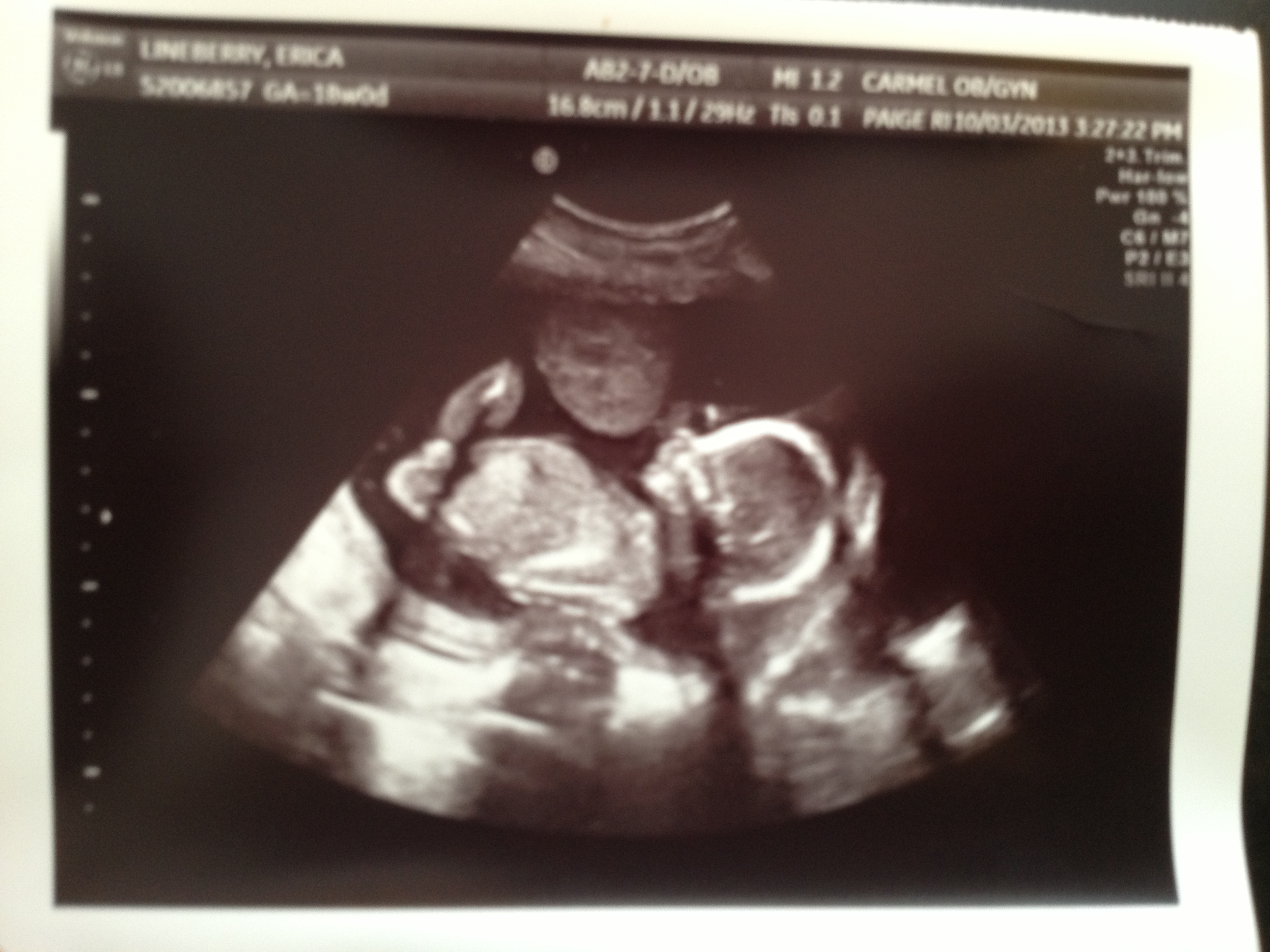 Pregnancy Update Weeks And The Gender Ultrasound Cragmama